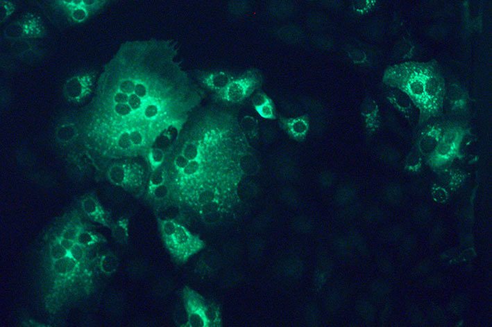 Mit MERS-Coronavirus (grün) infizierte Nierenzellen eines Affen (© Müller/Charité).